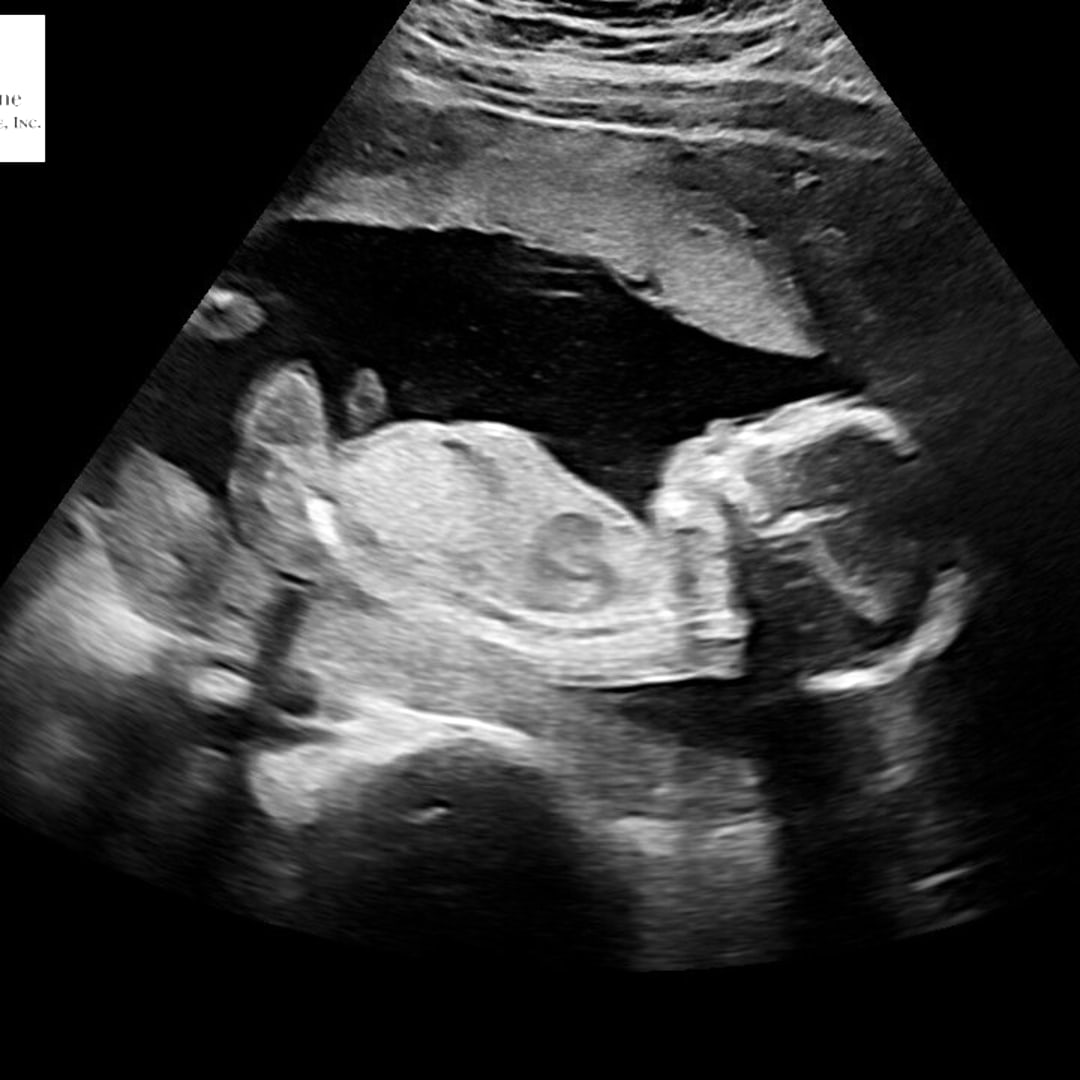 Photo shared by Alexandra for their Babylist baby registry.