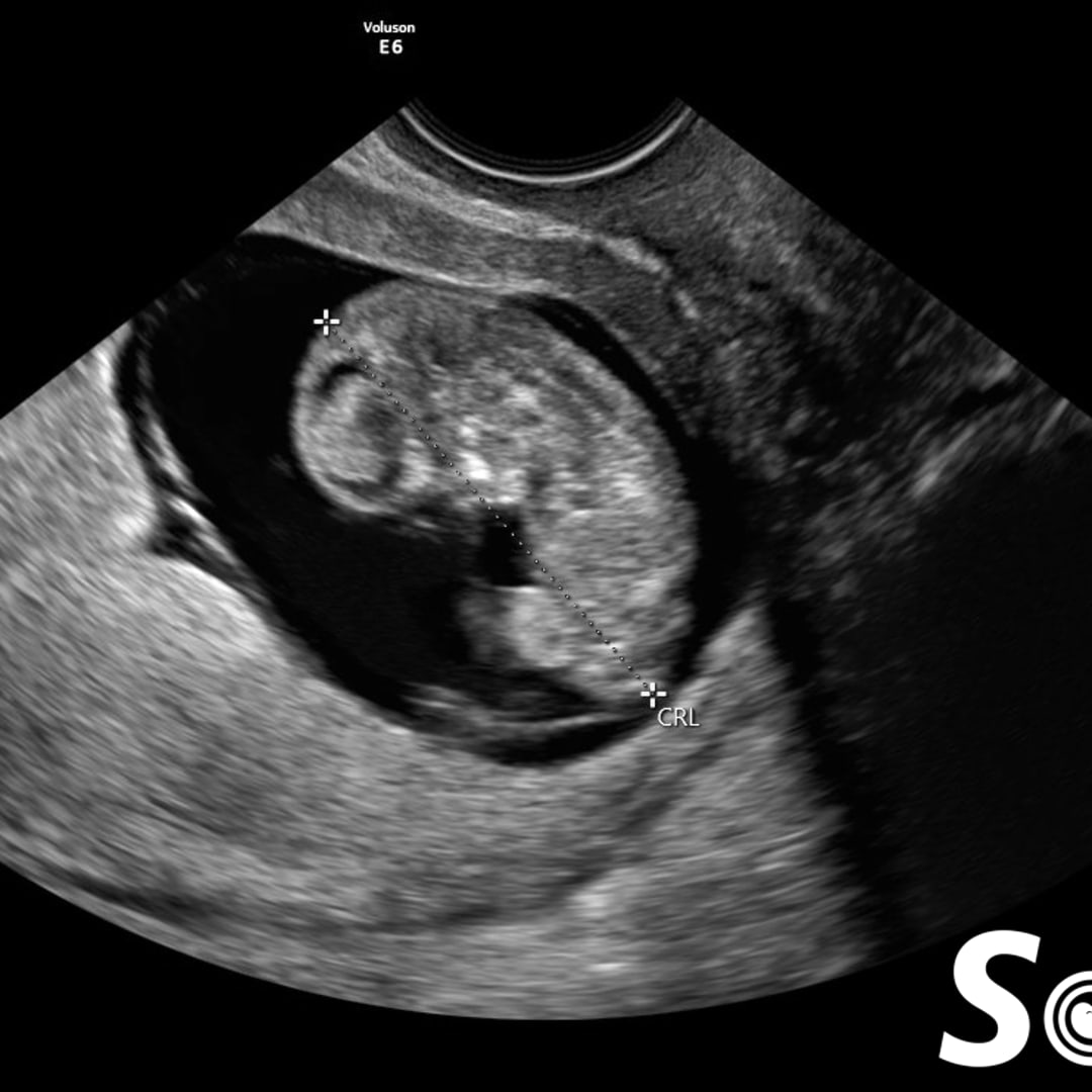 Photo shared by Danielle for their Babylist baby registry.