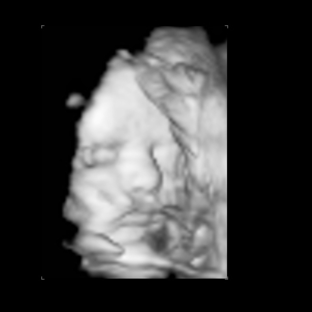 Photo shared by Nichole for their Babylist baby registry.