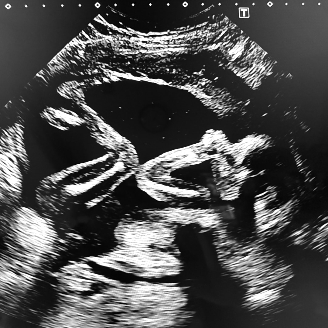 Photo shared by Francesca for their Babylist baby registry.