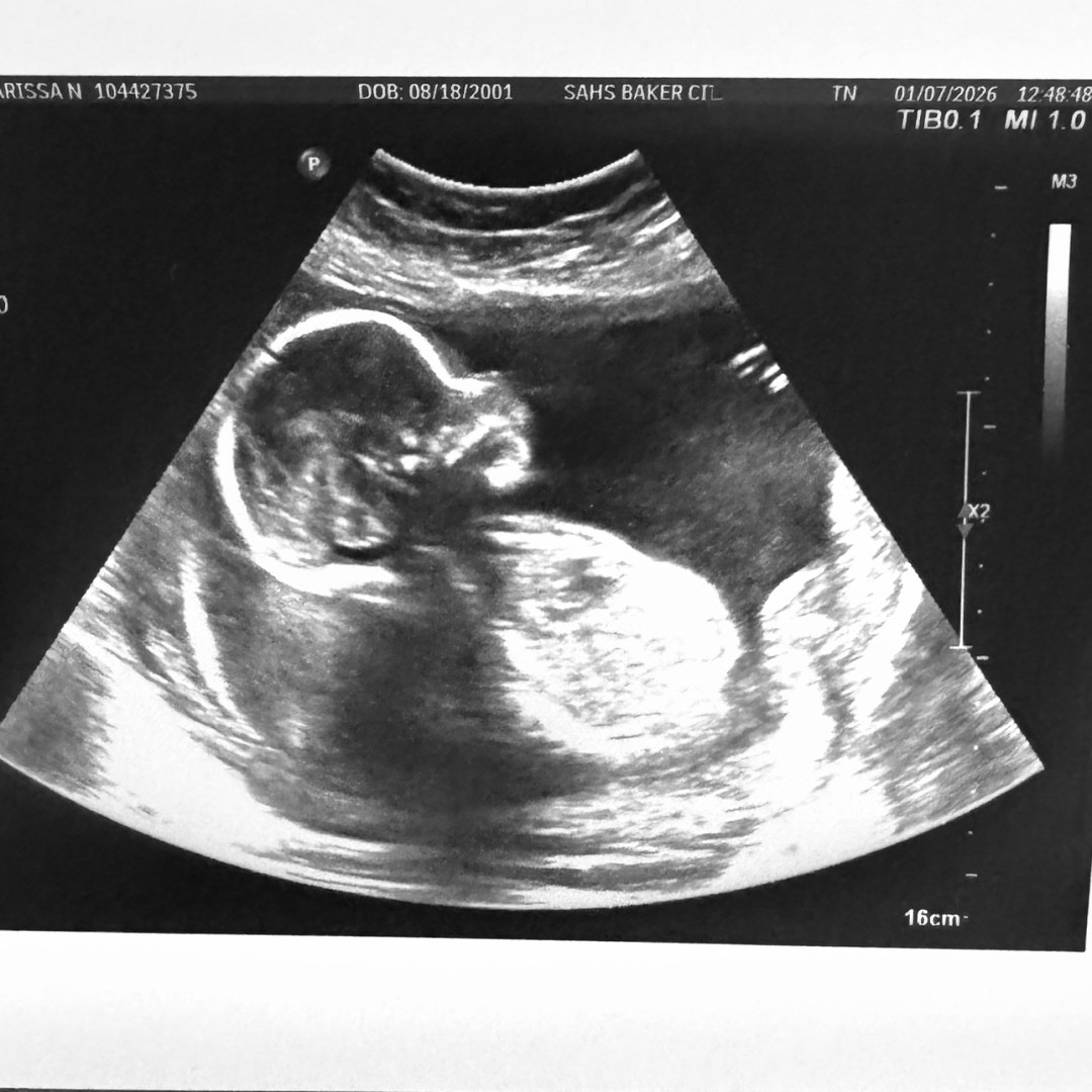 Photo shared by Karissa for their Babylist baby registry.