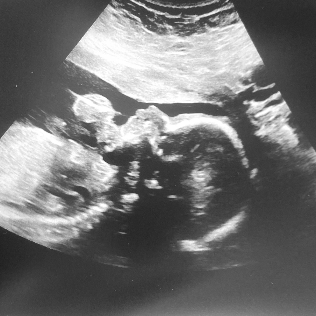 Photo shared by Alaina for their Babylist baby registry.