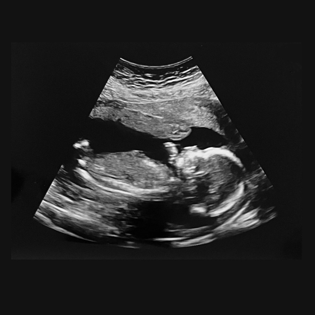 Photo shared by Kayla for their Babylist baby registry.