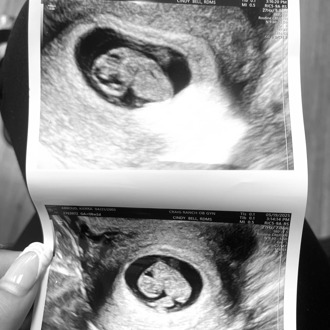 Photo shared by Jaylen for their Babylist baby registry.