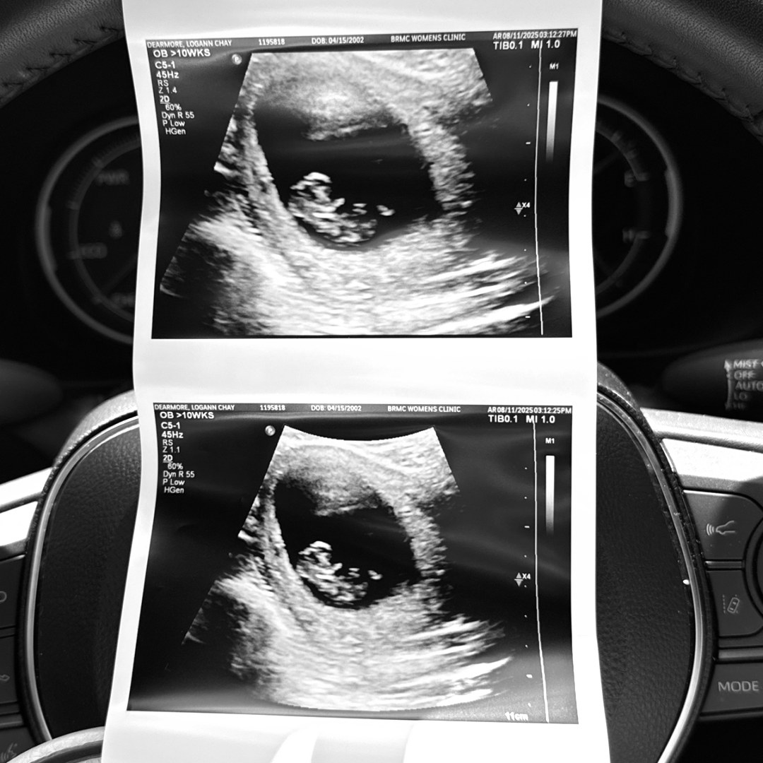 Photo shared by Logann for their Babylist baby registry.