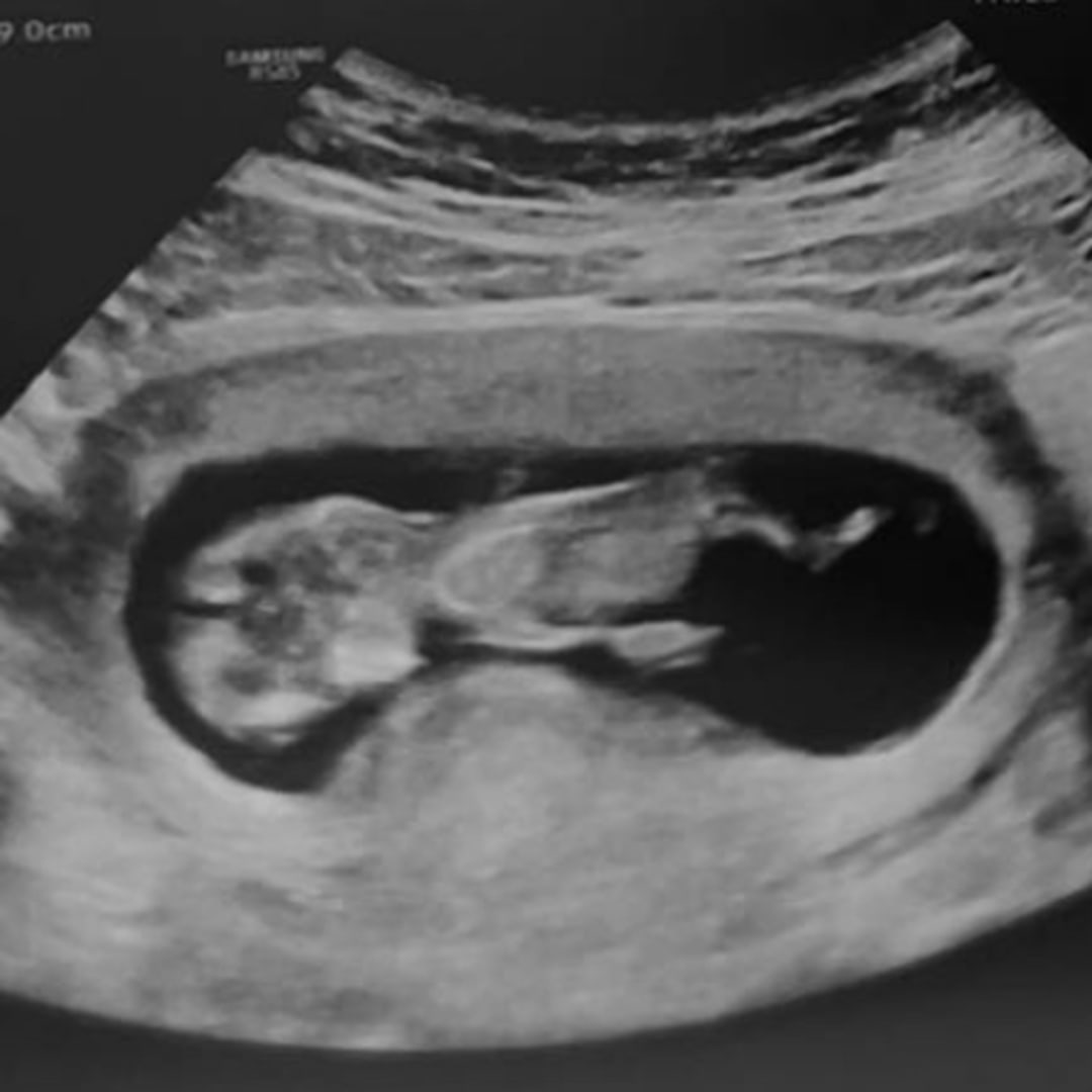 Photo shared by Savannah for their Babylist baby registry.