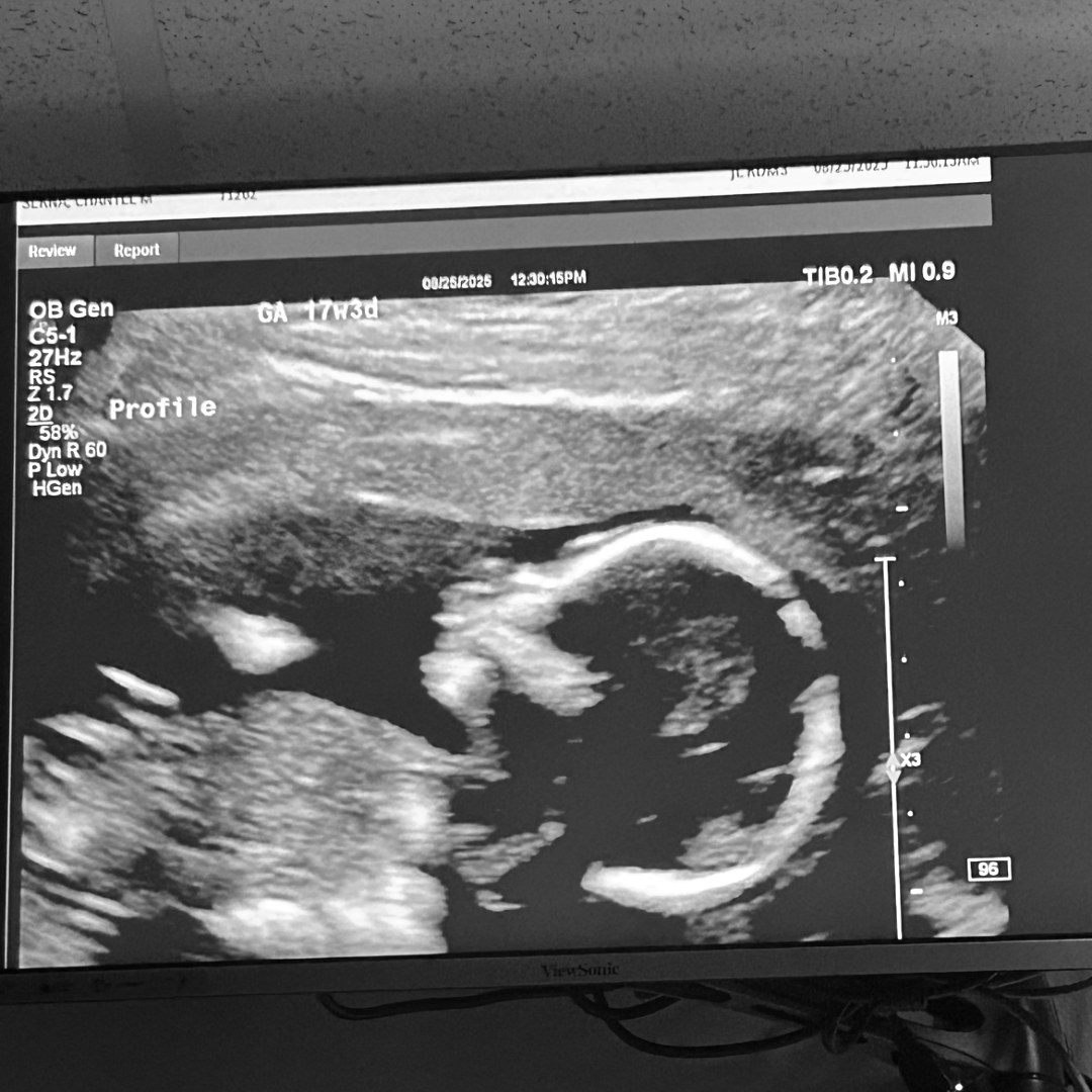 Photo shared by Chantel for their Babylist baby registry.