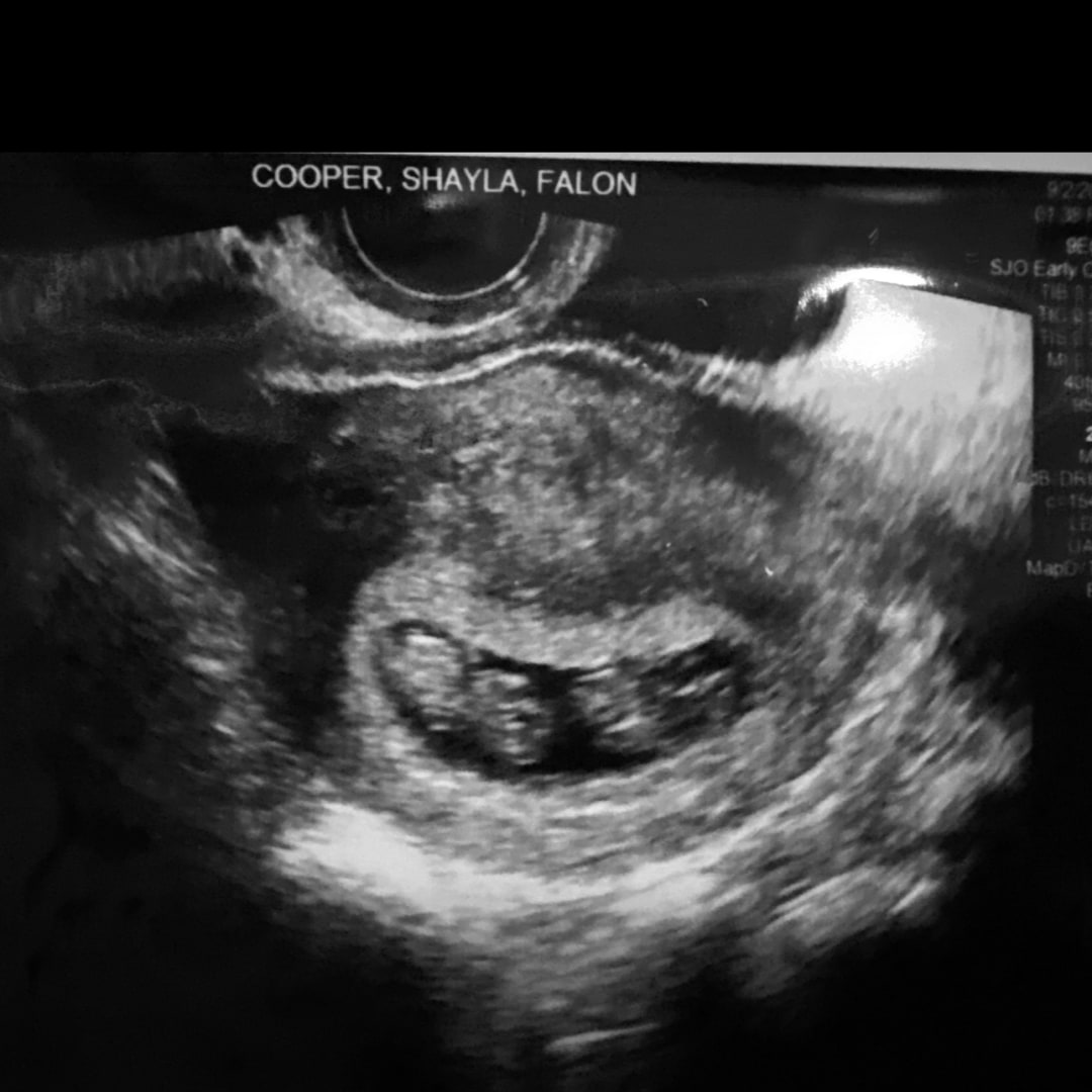 Photo shared by Shayla for their Babylist baby registry.