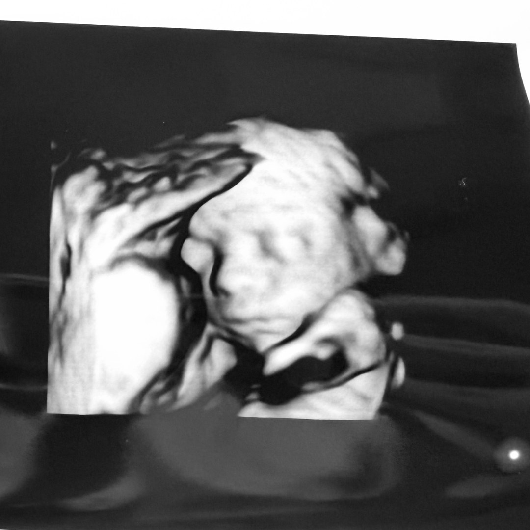 Photo shared by Caitlin for their Babylist baby registry.