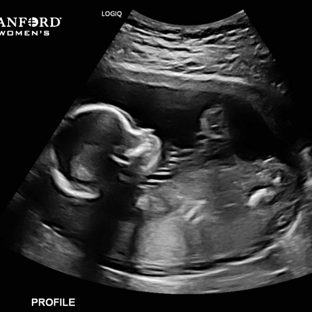 Photo shared by Asia + John for their Babylist baby registry.