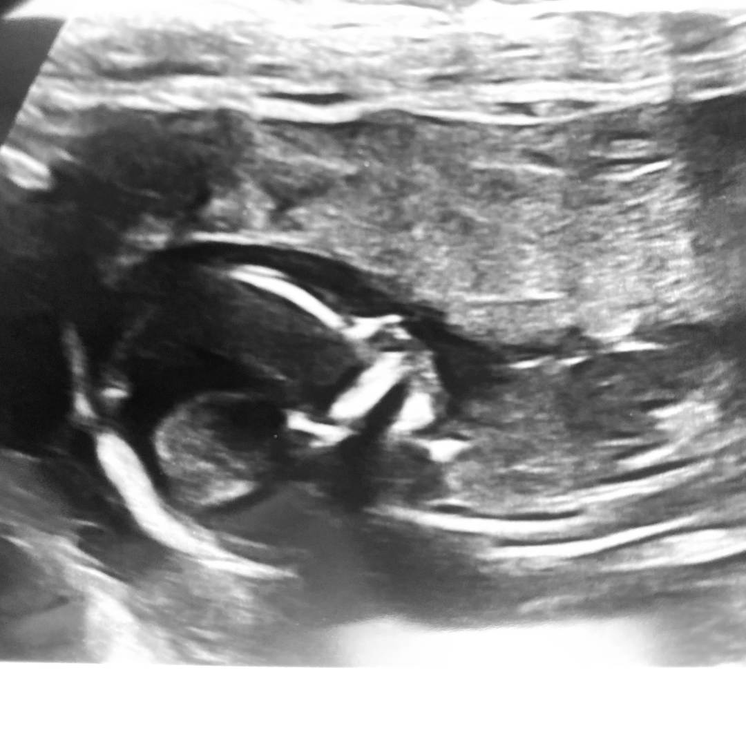 Photo shared by Cassidy for their Babylist baby registry.