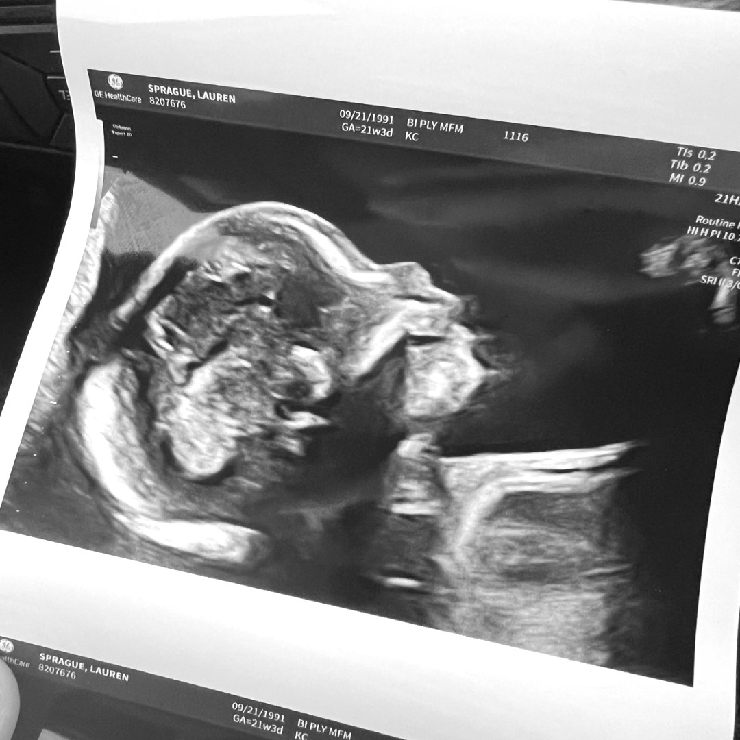 Photo shared by Lauren for their Babylist baby registry.