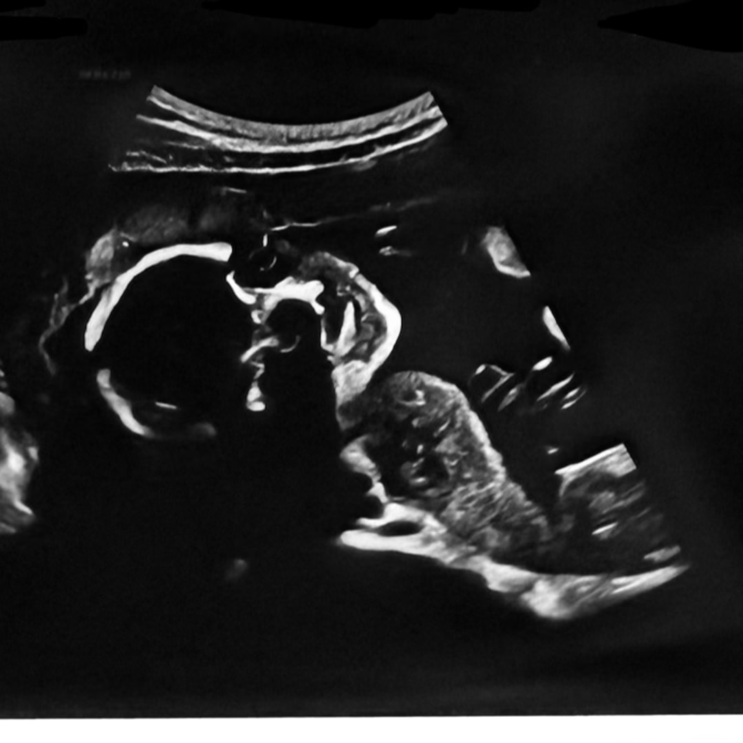 Photo shared by Allie for their Babylist baby registry.
