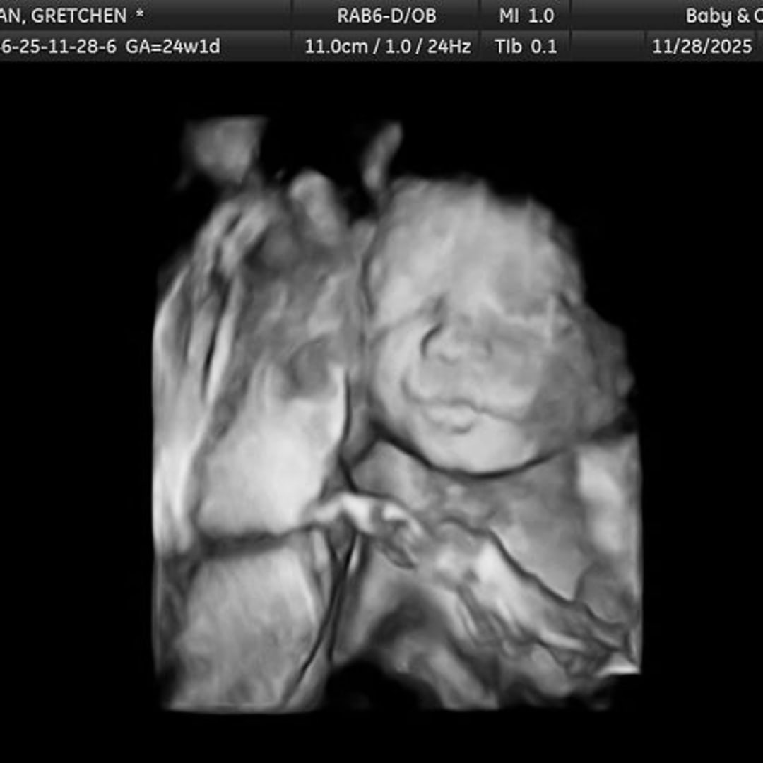 Photo shared by Gretchen for their Babylist baby registry.