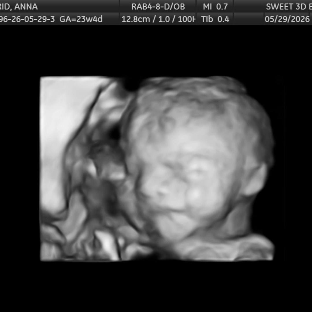 Photo shared by Anna for their Babylist baby registry.