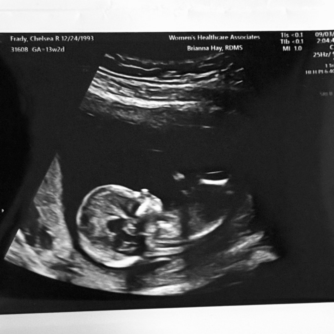Photo shared by Chelsea for their Babylist baby registry.