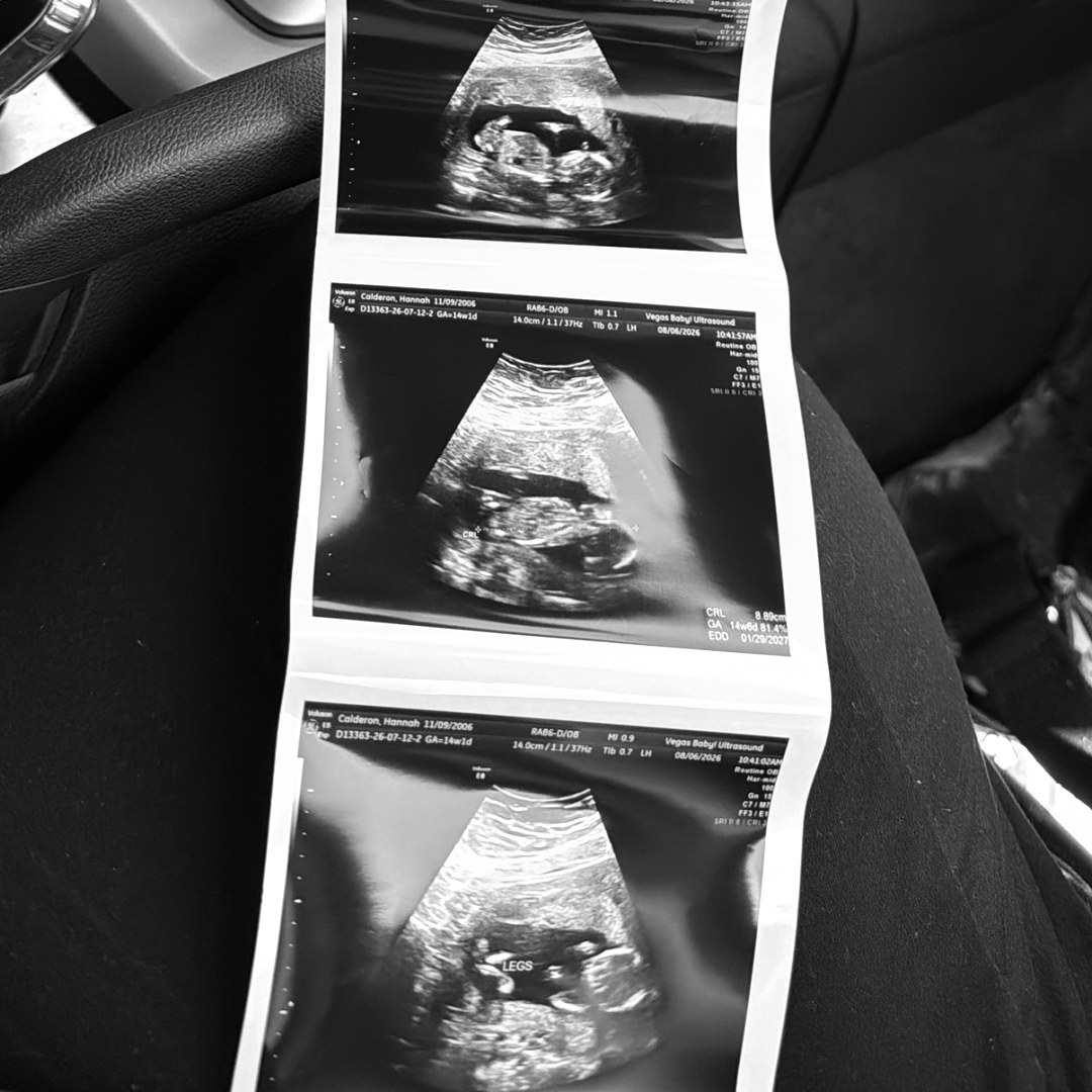 Photo shared by Hannah for their Babylist baby registry.