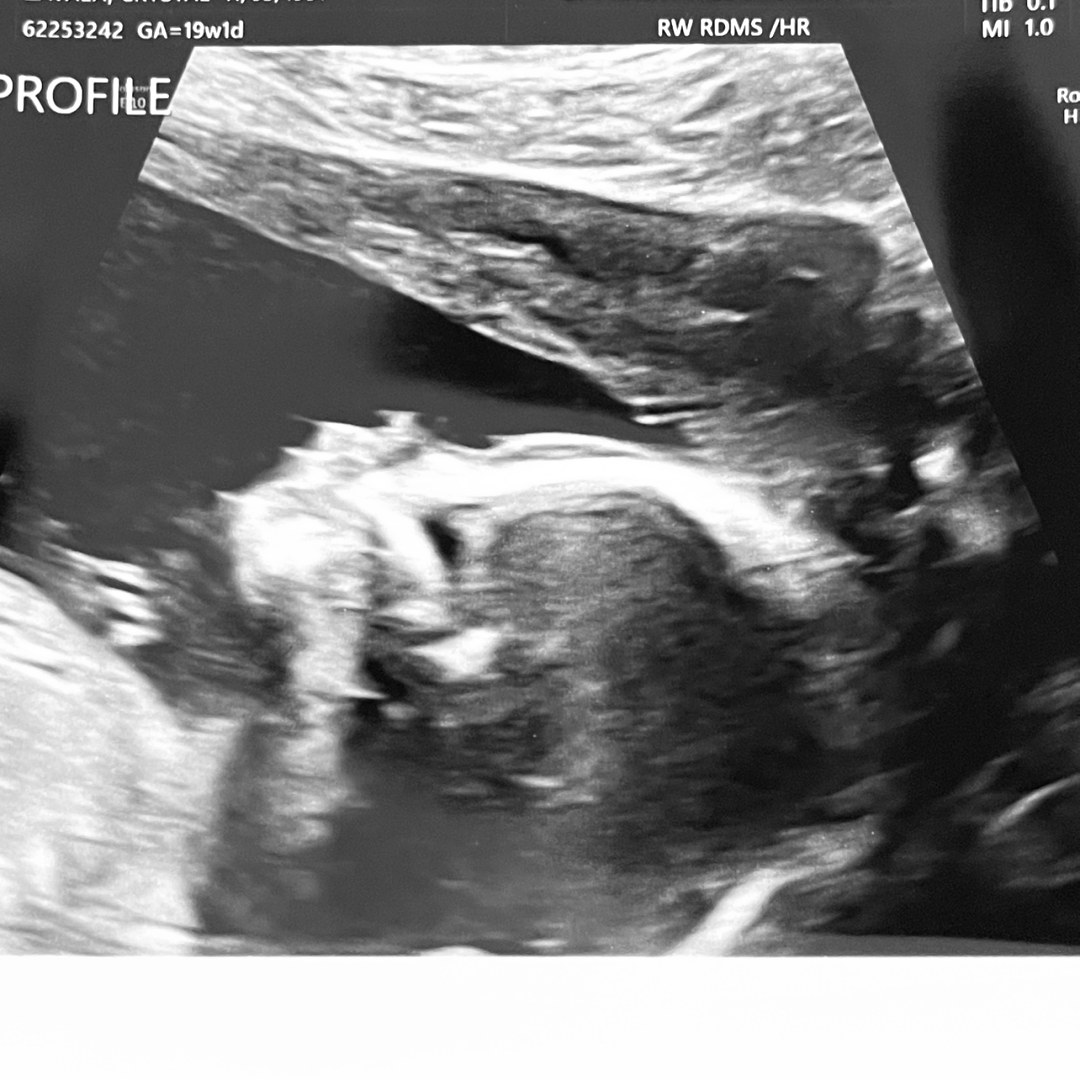 Photo shared by Crystal for their Babylist baby registry.