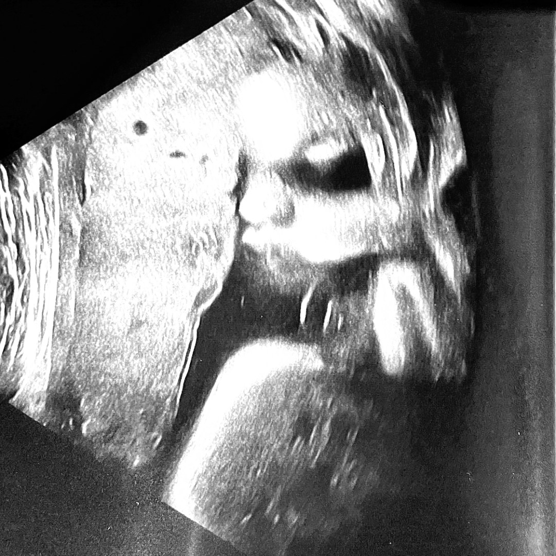 Photo shared by Michelle for their Babylist baby registry.