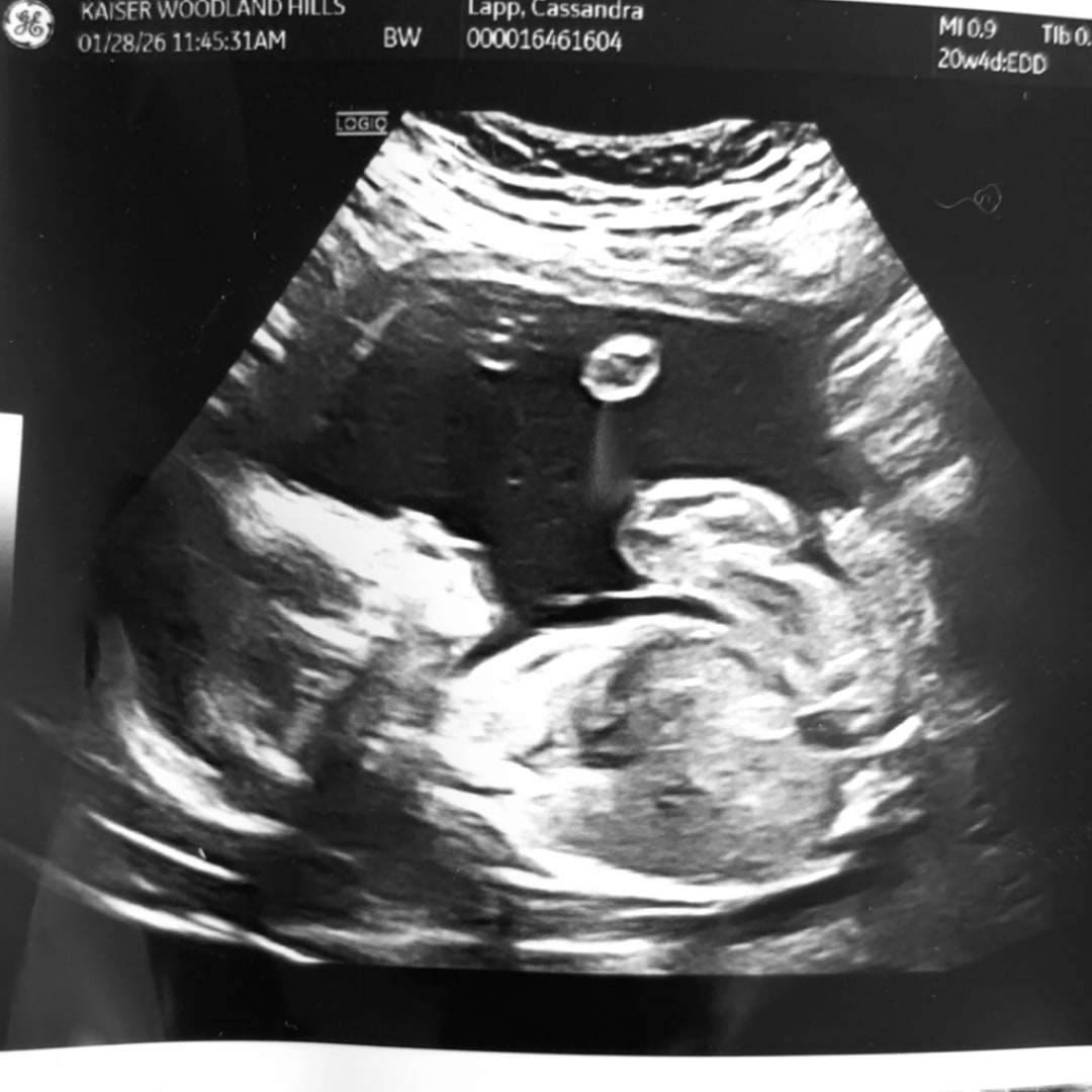 Photo shared by Cassandra for their Babylist baby registry.