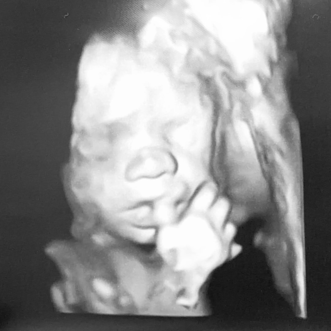 Photo shared by Audrey for their Babylist baby registry.