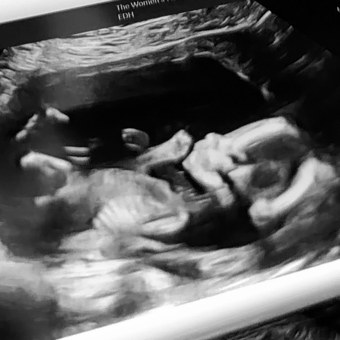 Photo shared by Heather for their Babylist baby registry.