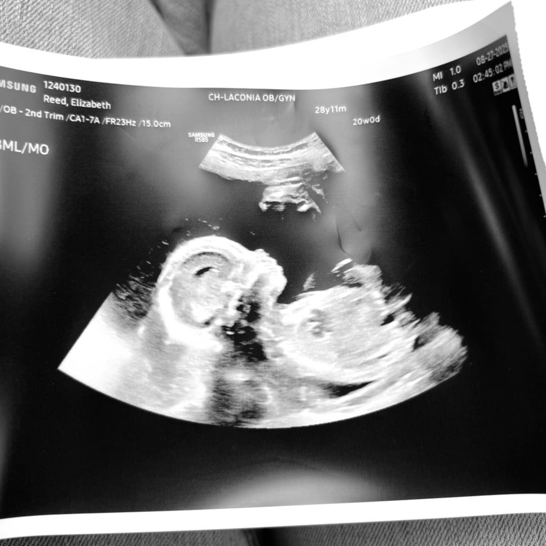 Photo shared by Elizabeth for their Babylist baby registry.