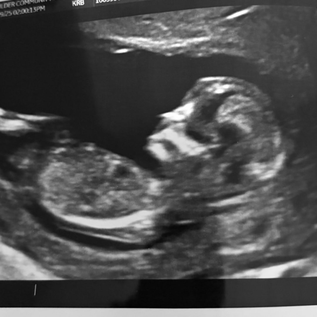 Photo shared by Morgan for their Babylist baby registry.