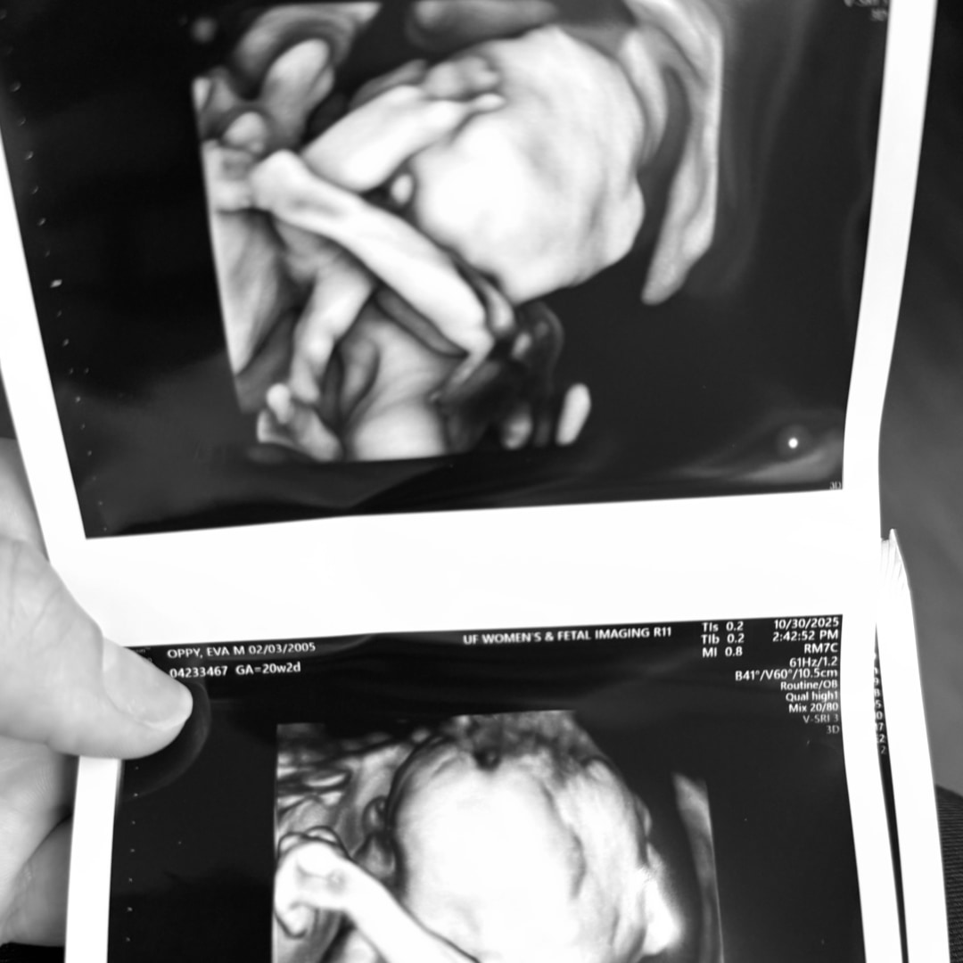 Photo shared by Eva for their Babylist baby registry.