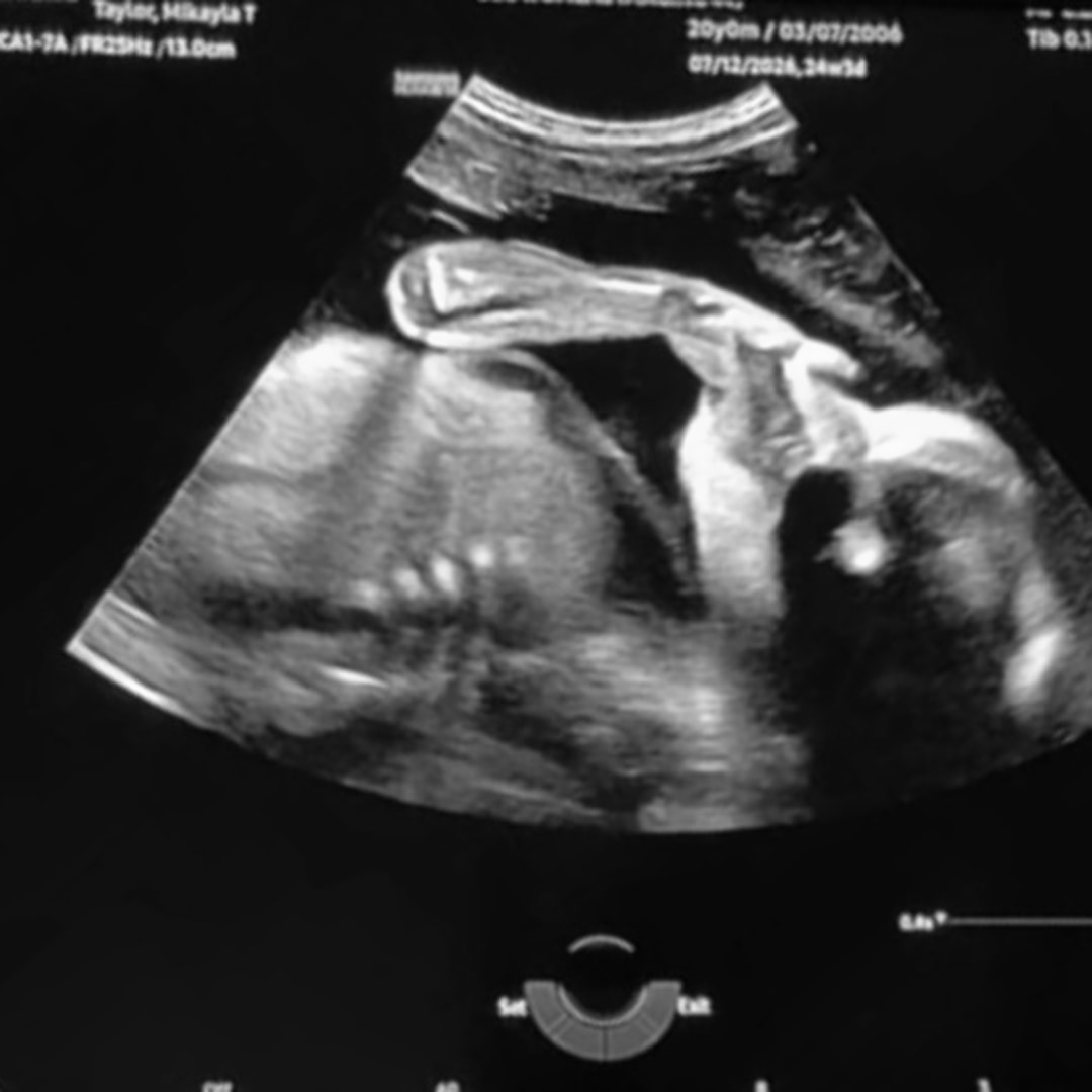 Photo shared by Rylee for their Babylist baby registry.