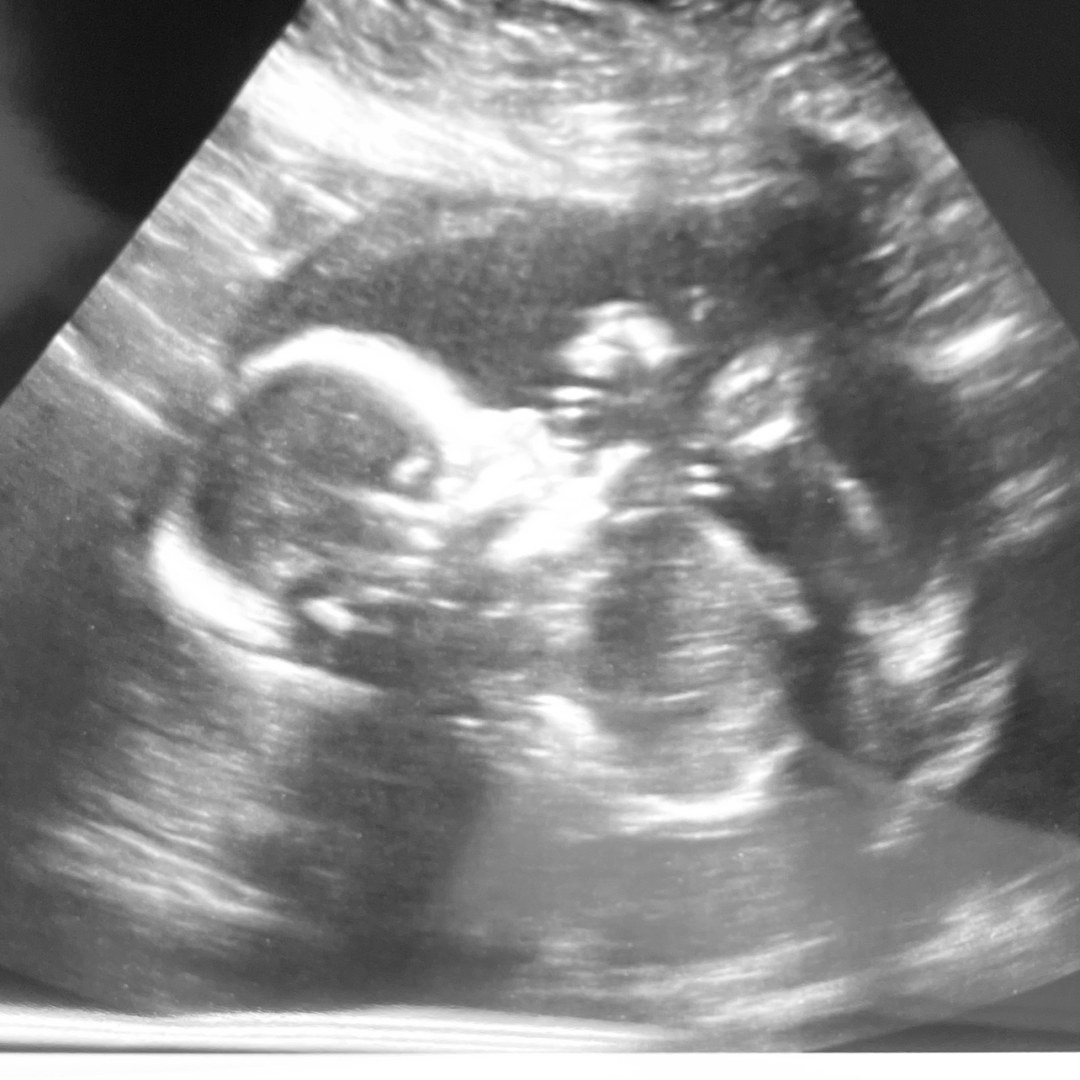 Photo shared by Jaylen for their Babylist baby registry.