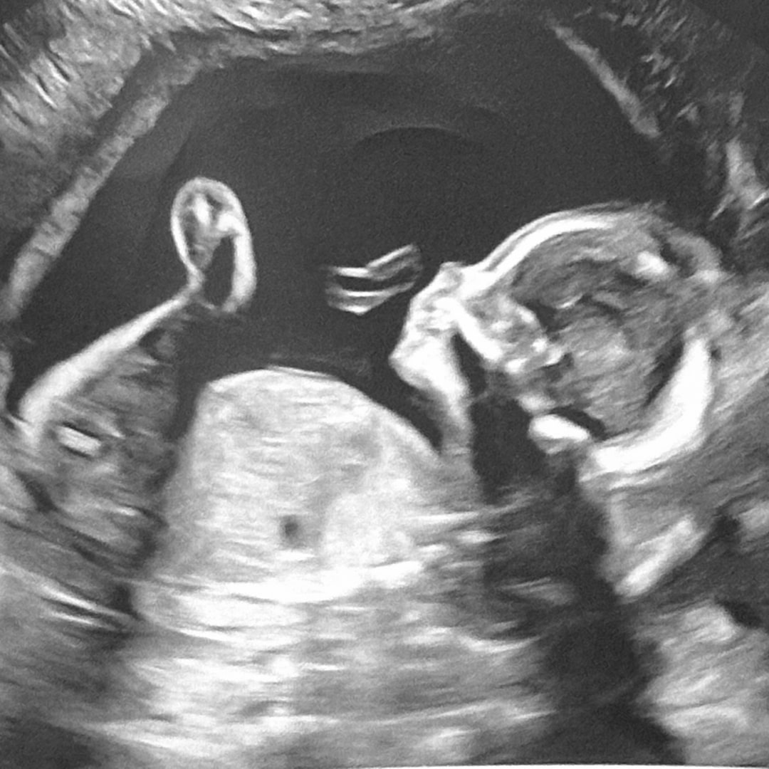 Photo shared by Hayley for their Babylist baby registry.