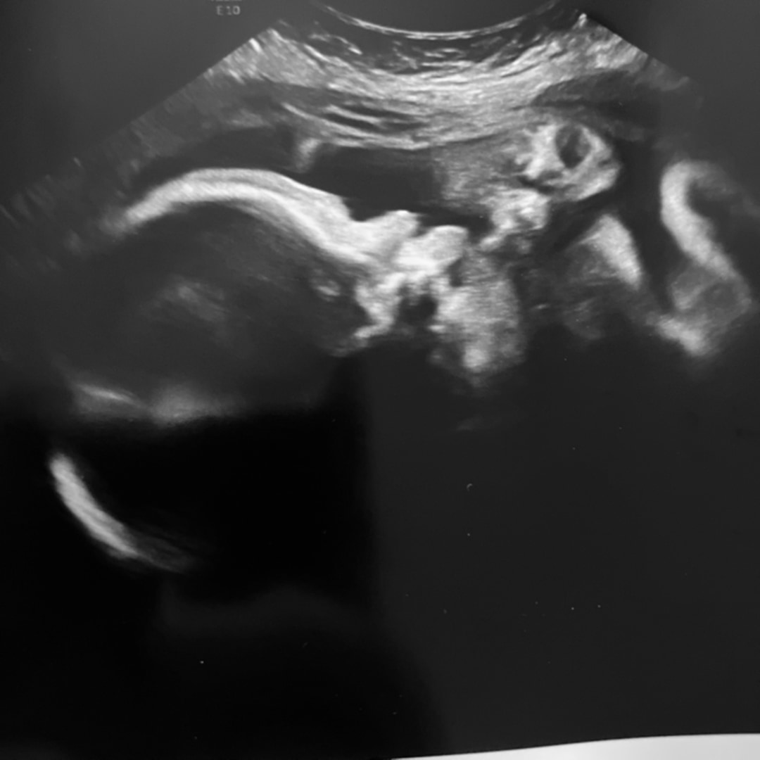 Photo shared by Joanna for their Babylist baby registry.