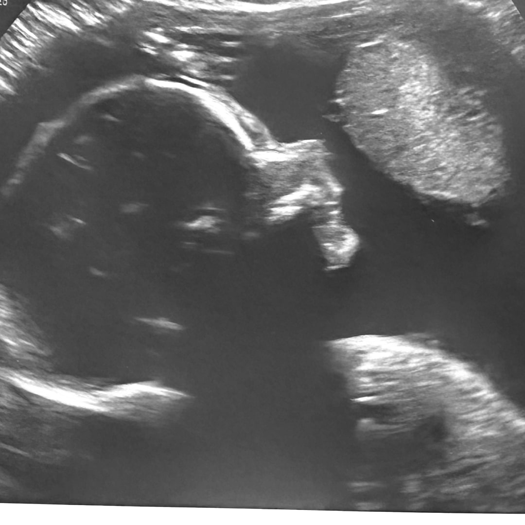 Photo shared by Marrisa for their Babylist baby registry.