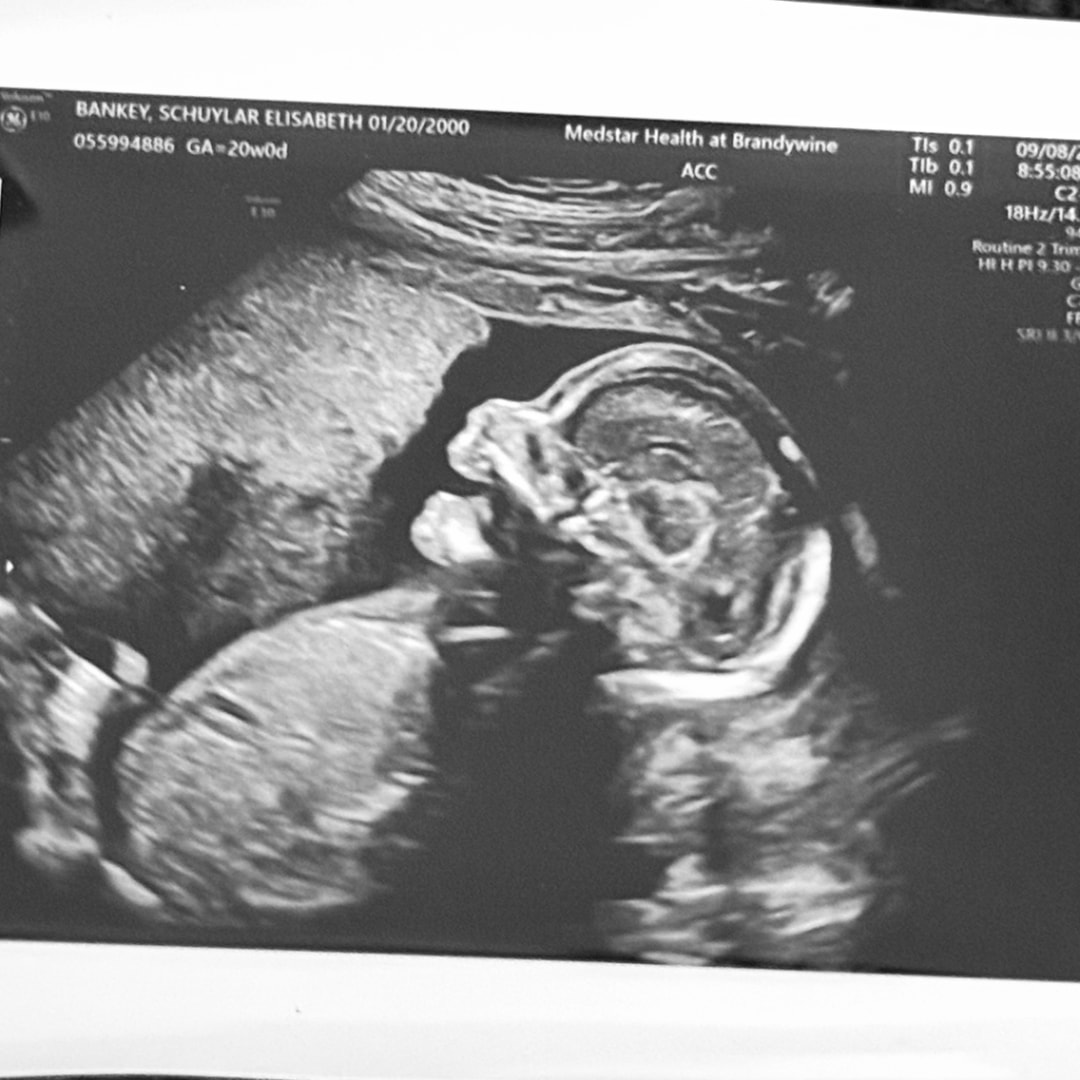 Photo shared by Schuylar for their Babylist baby registry.