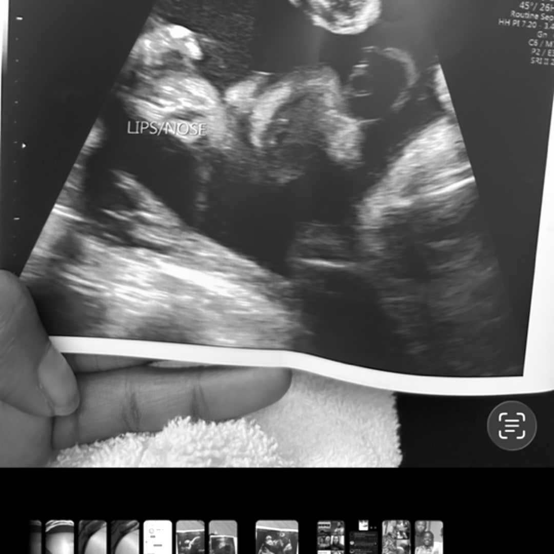 Photo shared by Sabrina for their Babylist baby registry.