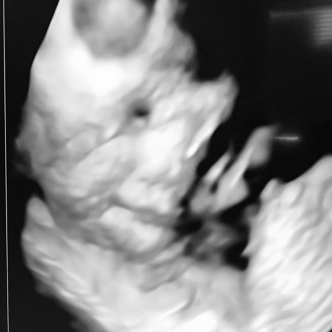 Photo shared by Candace for their Babylist baby registry.