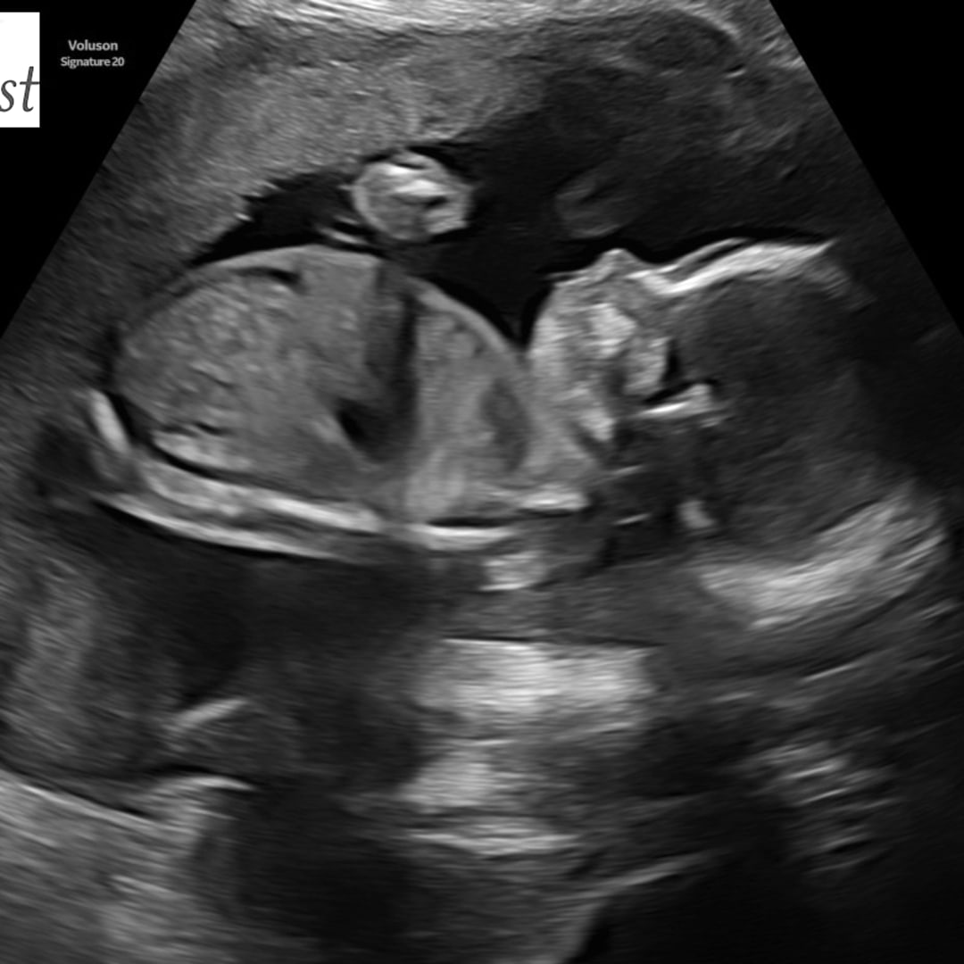 Photo shared by Rylee for their Babylist baby registry.