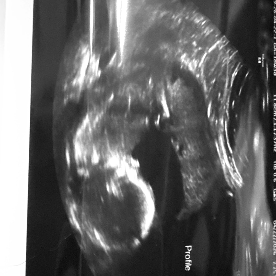 Photo shared by Haley for their Babylist baby registry.