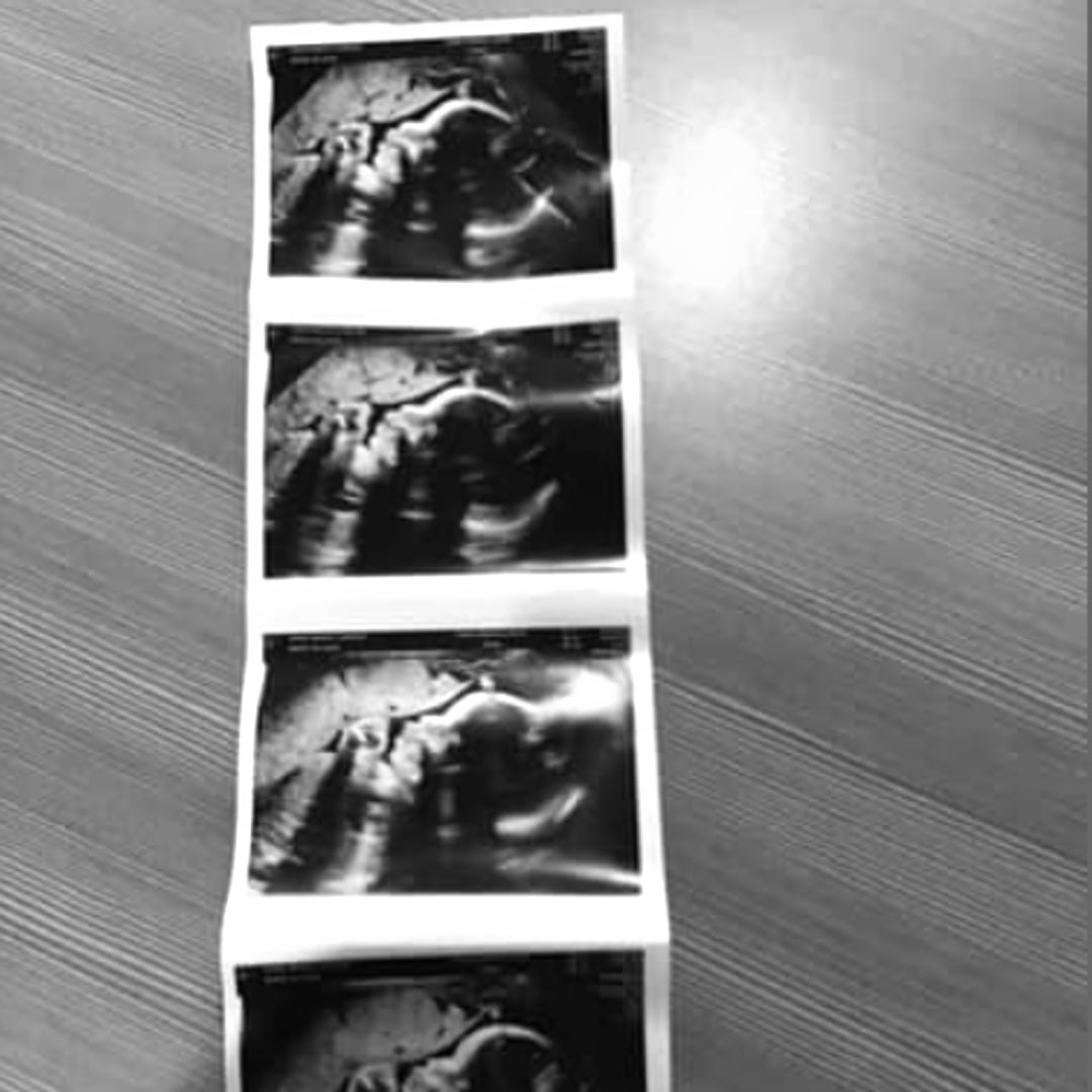Photo shared by Makayla for their Babylist baby registry.