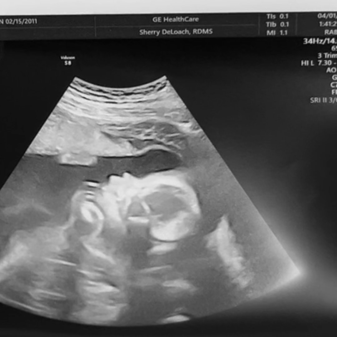 Photo shared by Ashten for their Babylist baby registry.