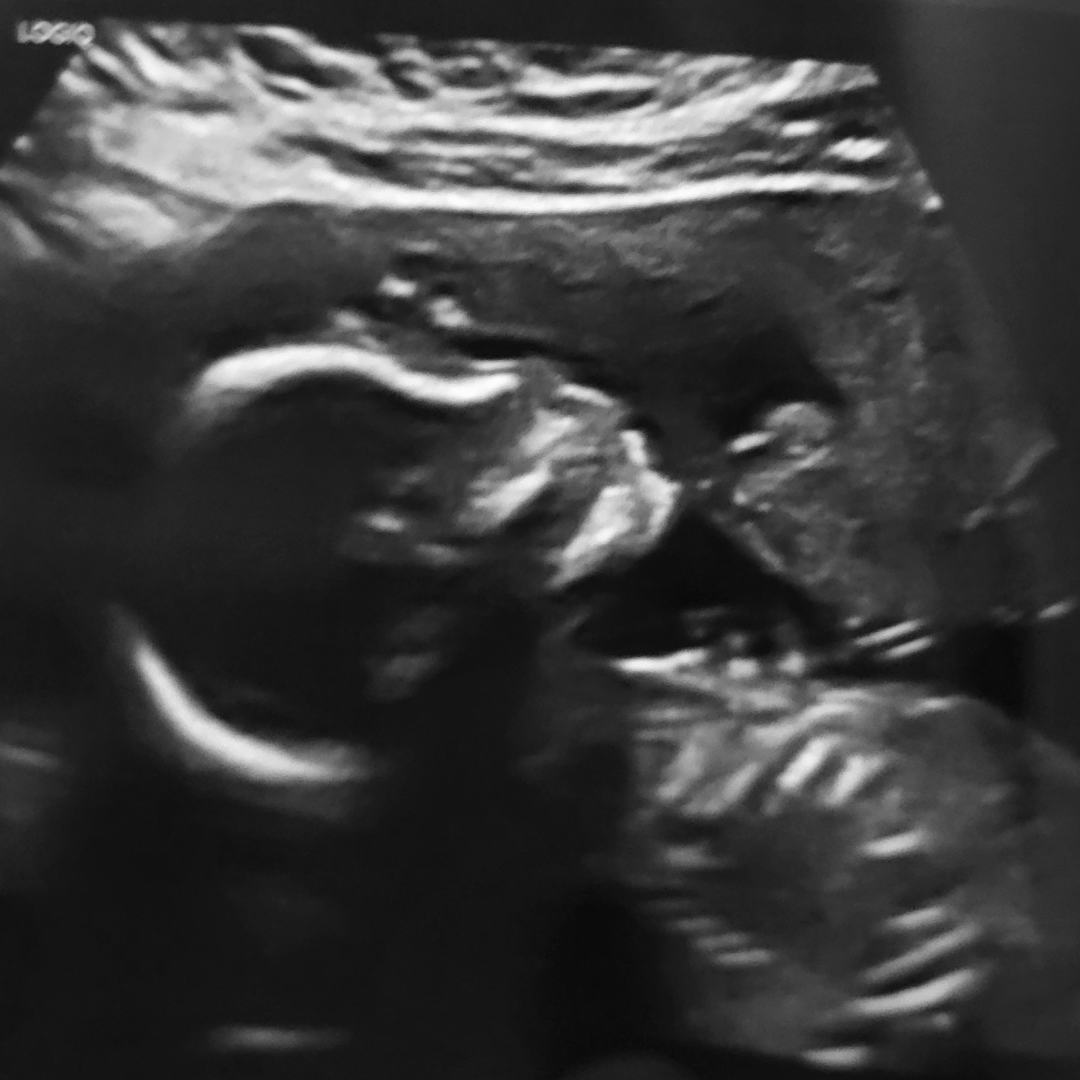 Photo shared by Chandler for their Babylist baby registry.