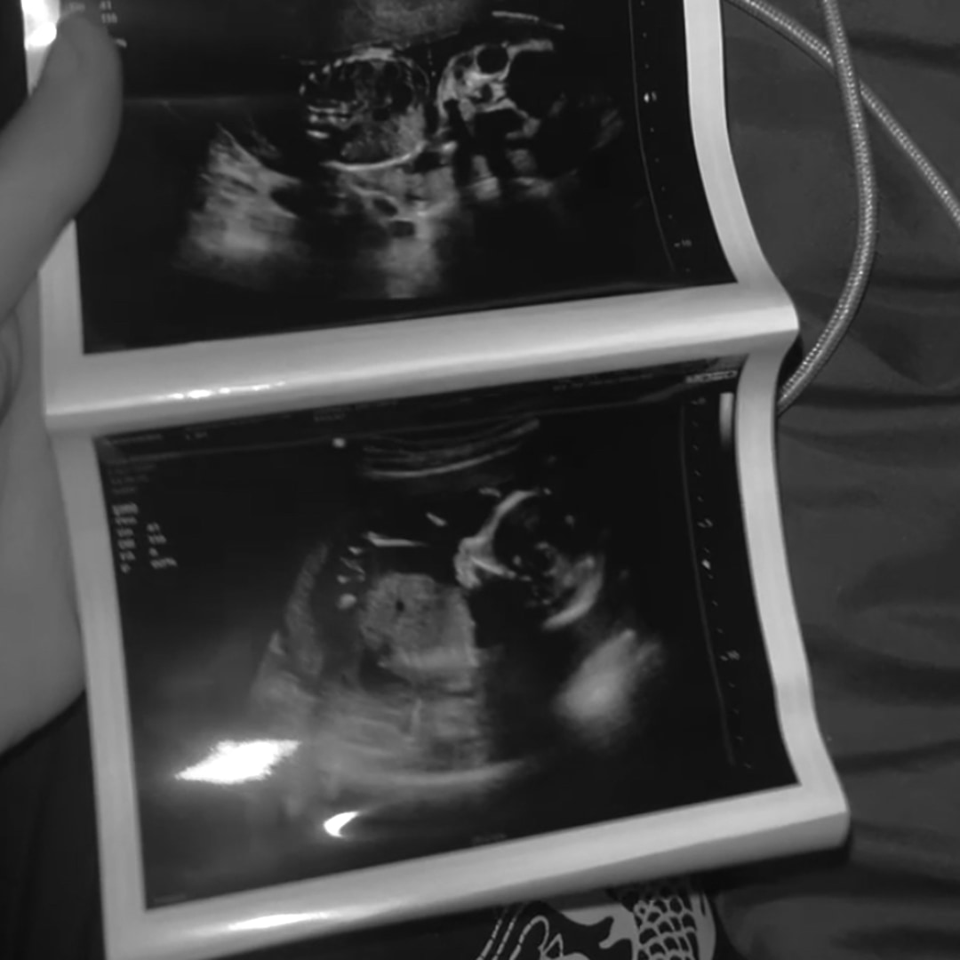Photo shared by Desy for their Babylist baby registry.