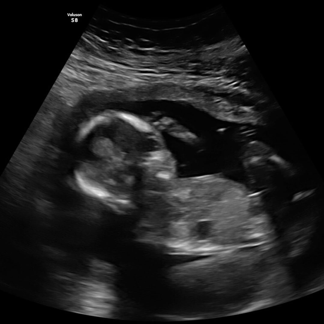 Photo shared by Shay for their Babylist baby registry.