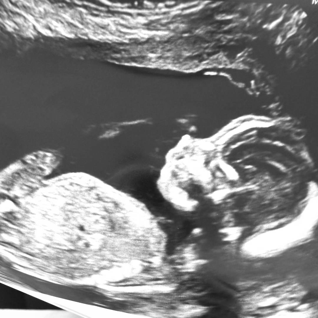 Photo shared by LeSha’ for their Babylist baby registry.