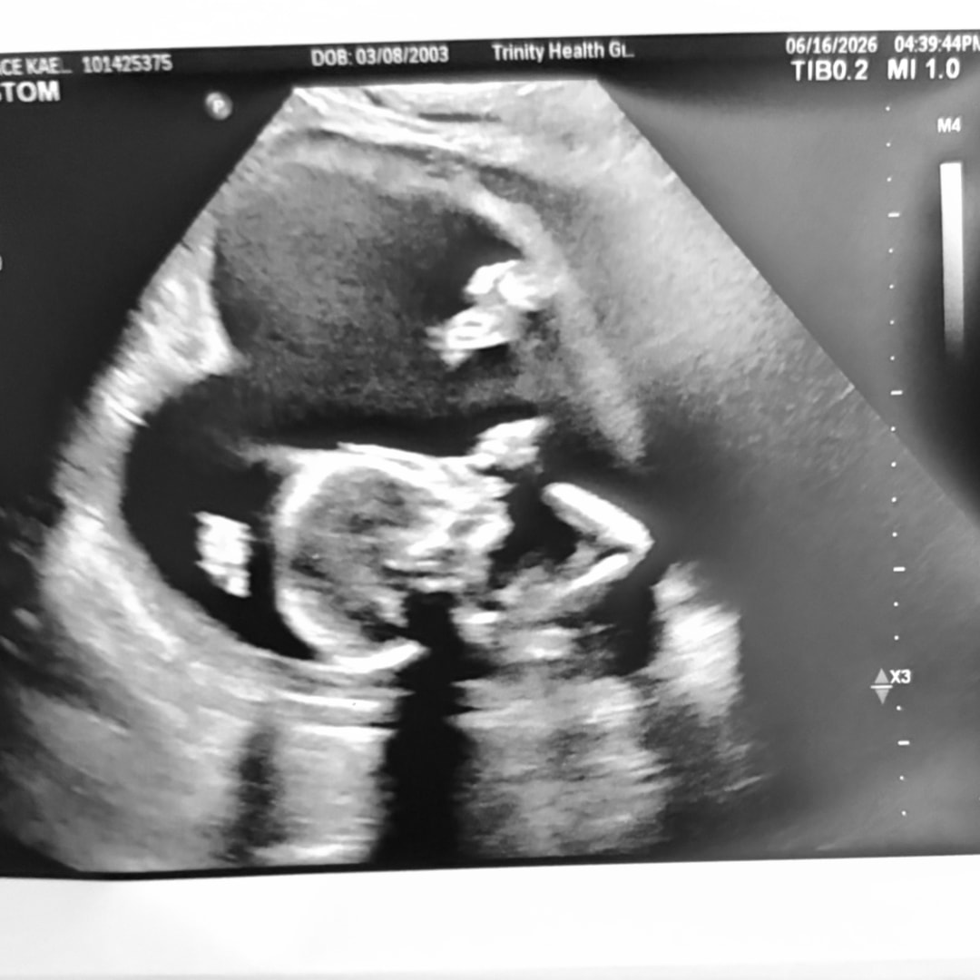 Photo shared by Grace for their Babylist baby registry.