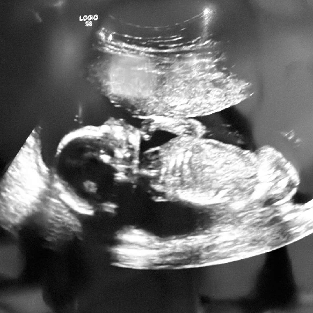 Photo shared by Kassandra for their Babylist baby registry.