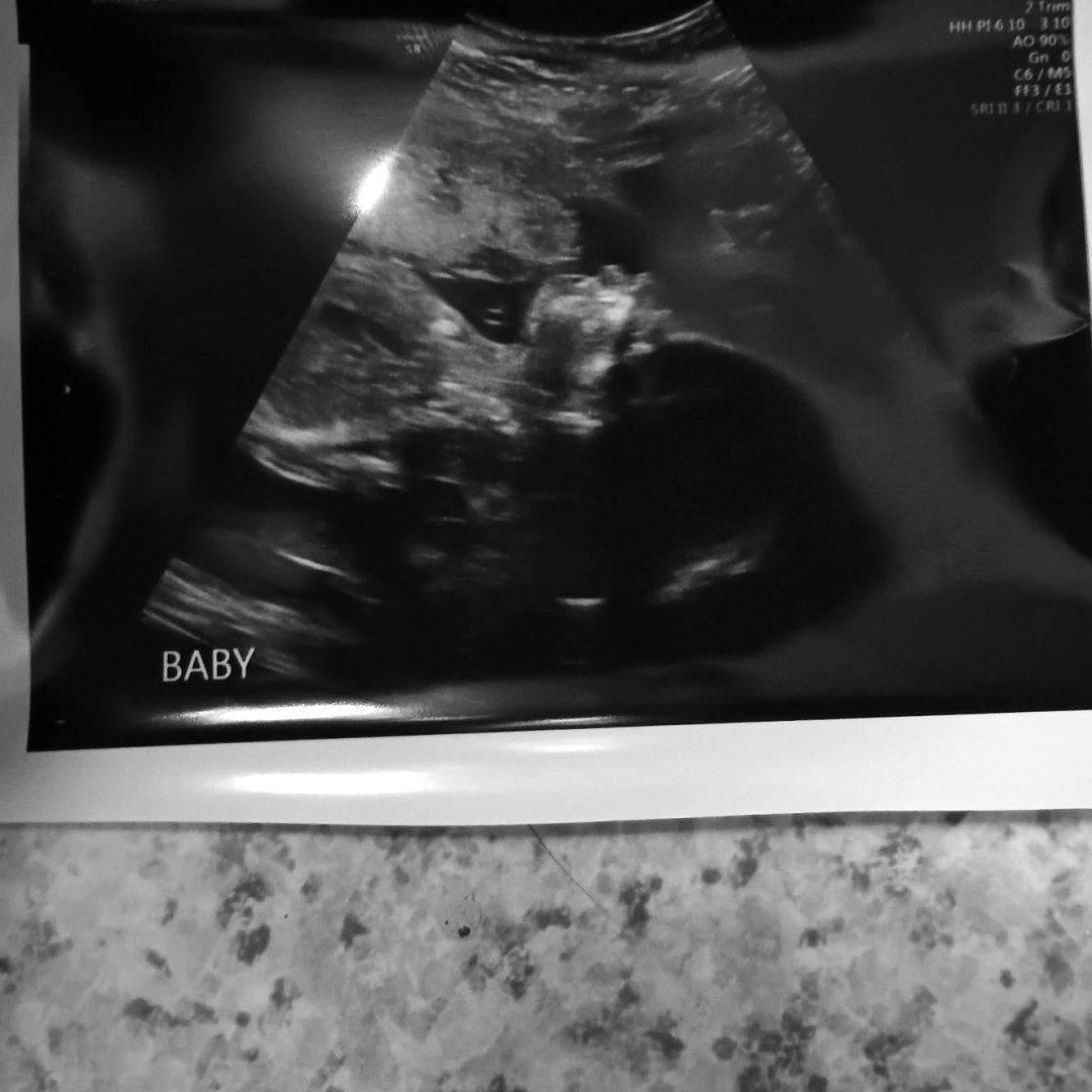 Photo shared by Ella for their Babylist baby registry.