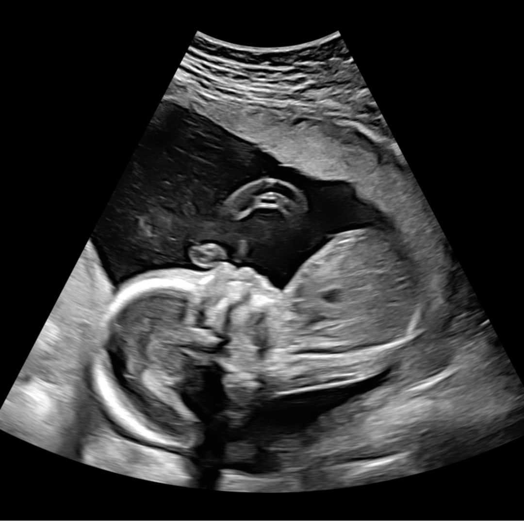 Photo shared by Olivia for their Babylist baby registry.