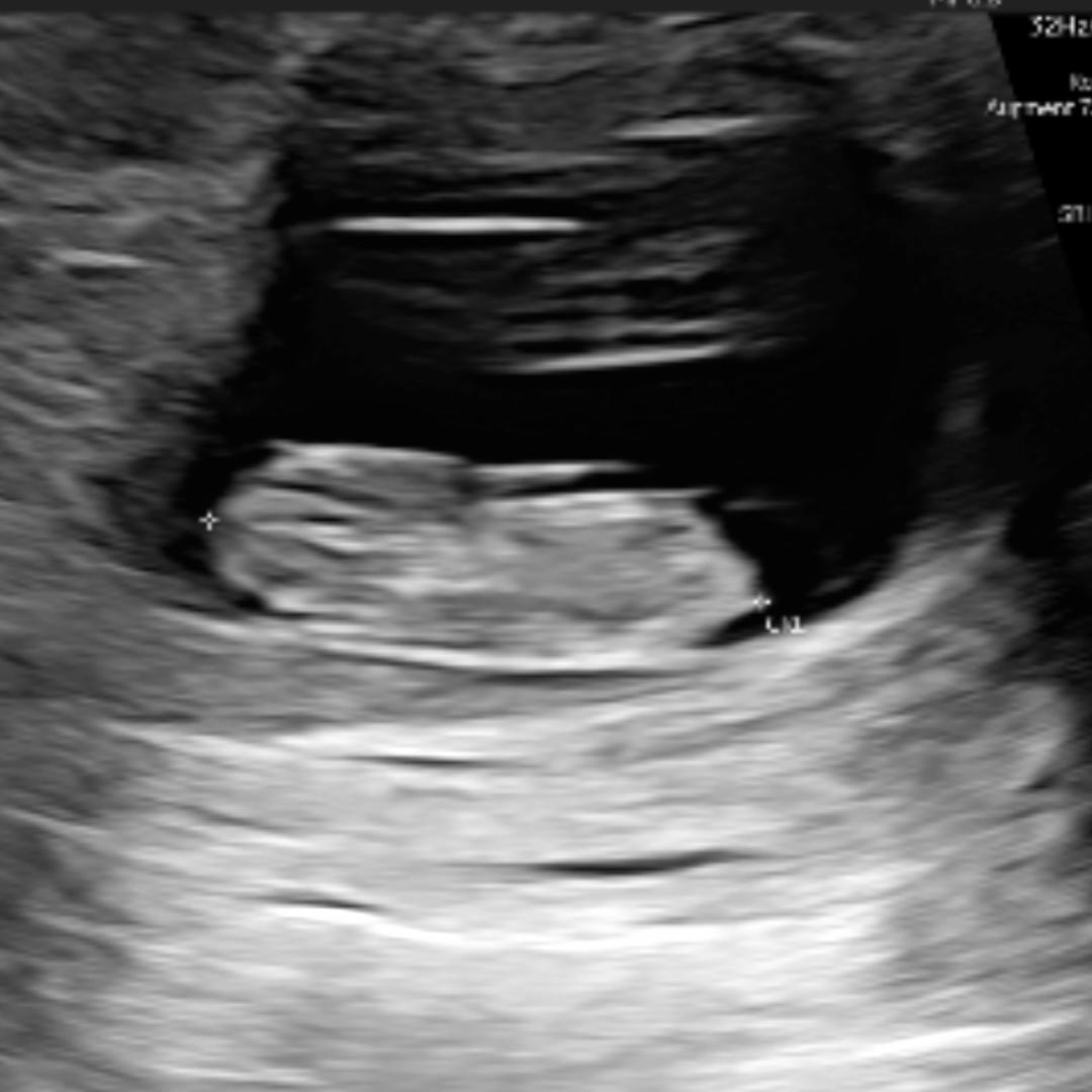 Photo shared by Alejandra for their Babylist baby registry.